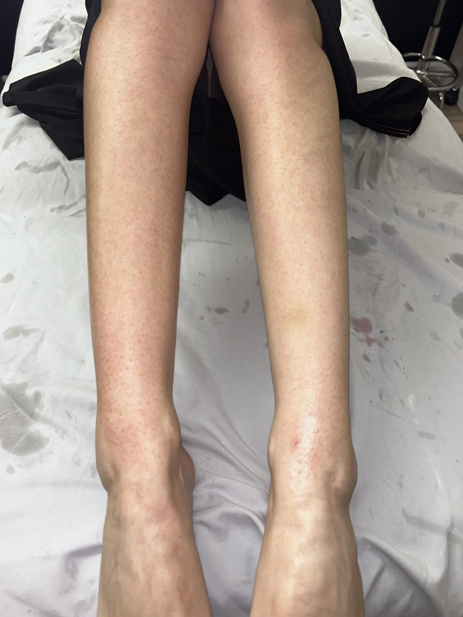 Full Leg Wax